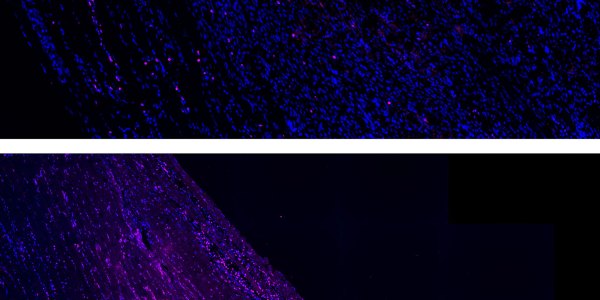 Treated and untreated muscles.