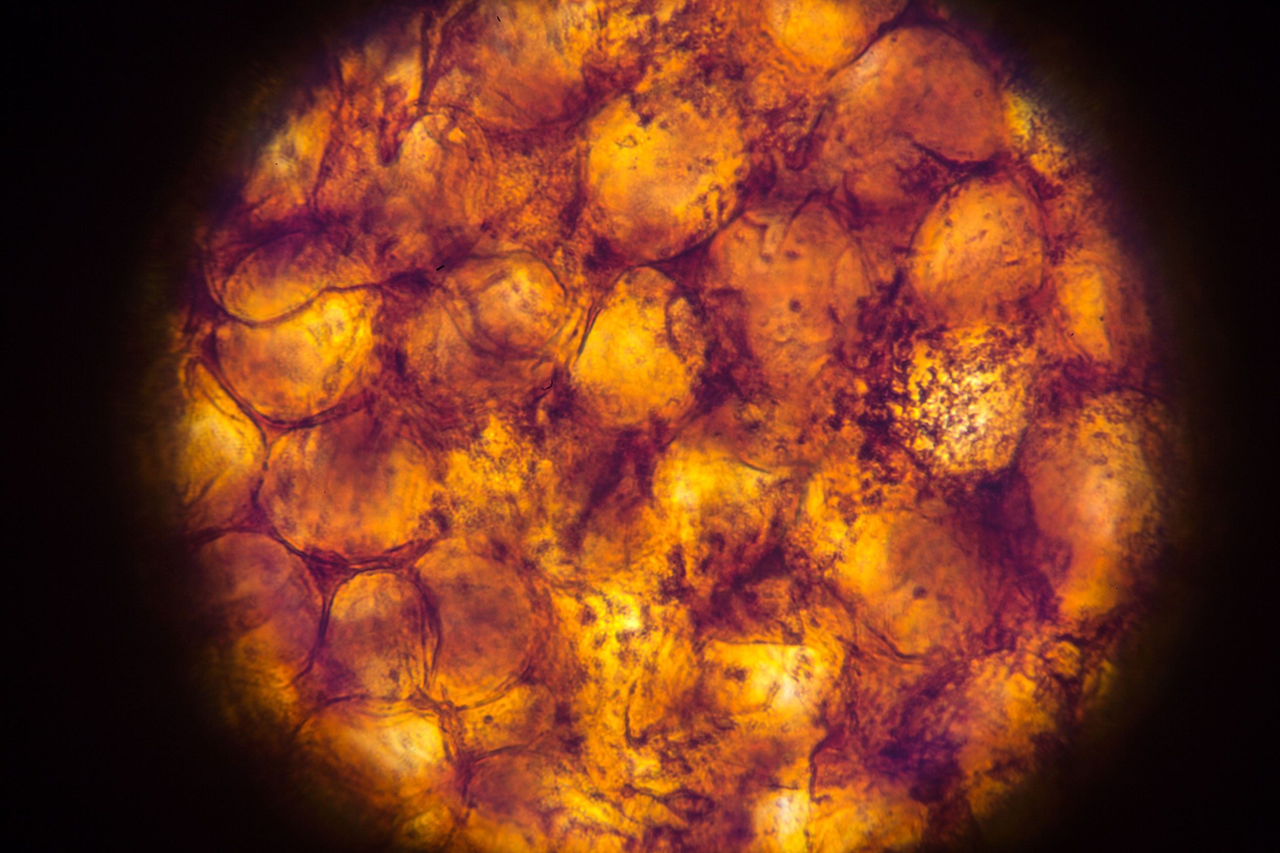 Липоциты. Бурый адипоцит. Жировая ткань бурая в микроскопе. Бурая жировая ткань ПЭТ кт. Жировые клетки микроскоп.