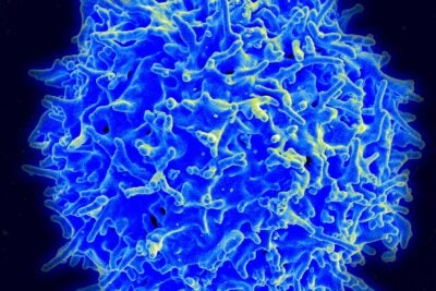 Healthy T cell.