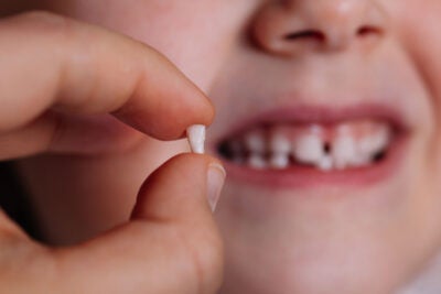 Incisor baby tooth.