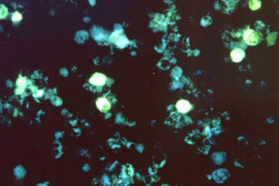 Cells infected with Epstein-Barr virus.