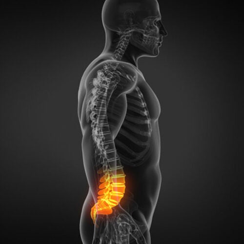 Illustration of lower back pain.