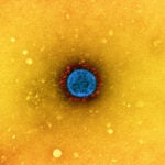 Image of the virus that causes COVID-19.
