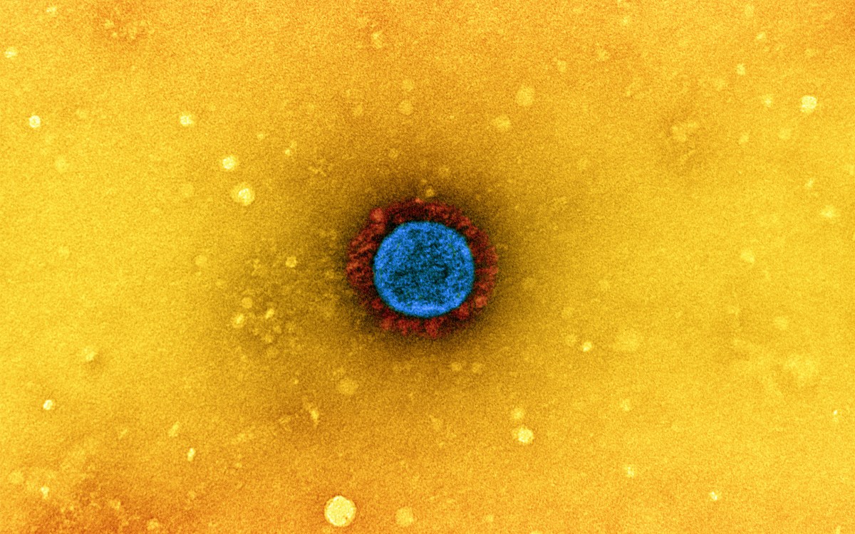 Image of the virus that causes COVID-19.
