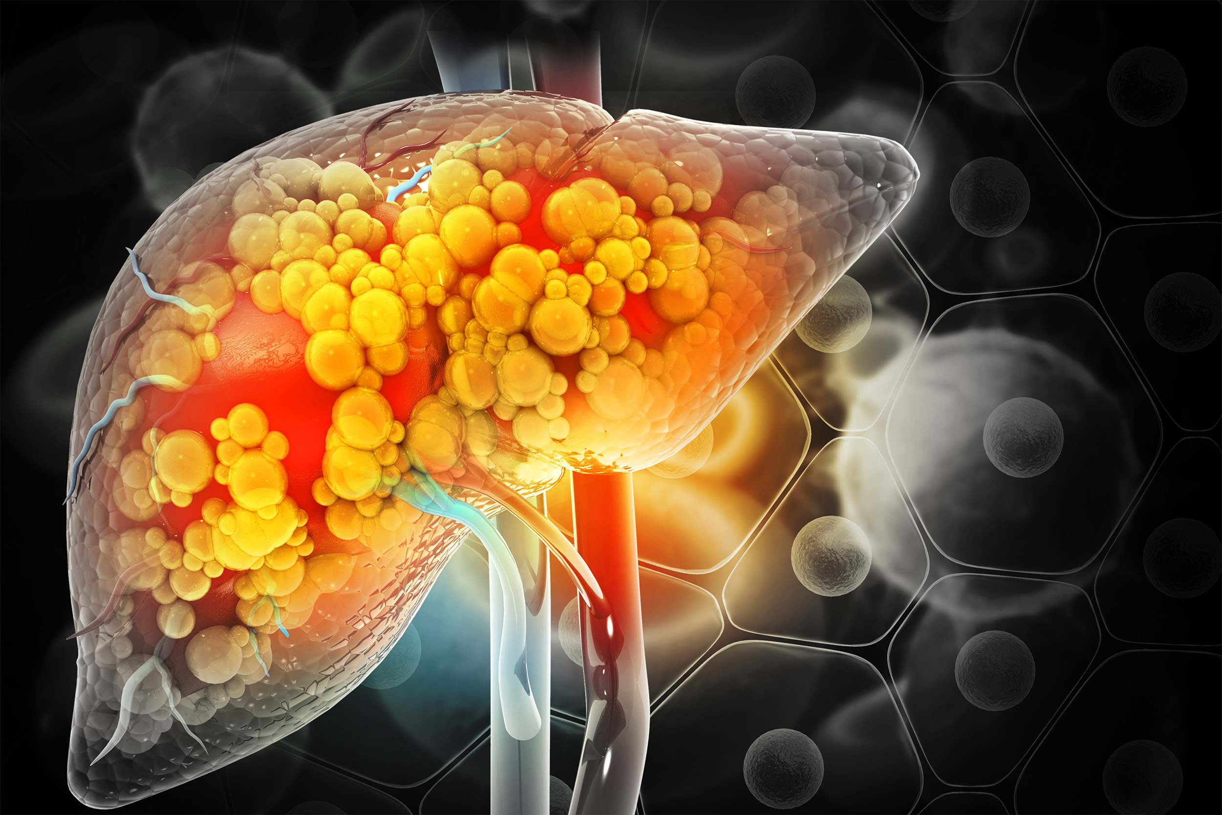 the-meaning-of-your-liver-blood-test-results-by-dr-pol-f-boudes-m