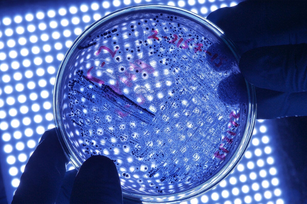 Close-up shot bacteria in petri dish.