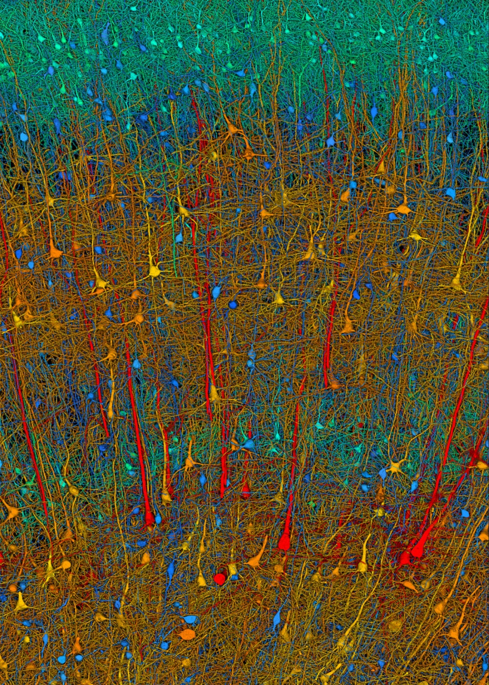 Microscopic image of brain with color-coded cells.