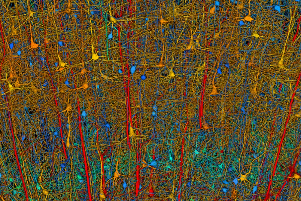Microscopic image of brain with color-coded cells.