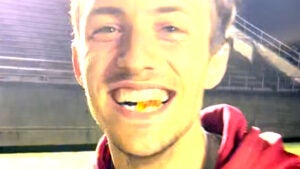 Will Sorenson clenches gummy bear he caught in his mouth between his teeth.