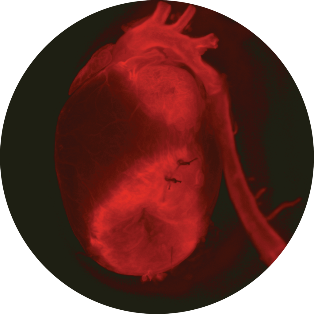 The heart and the aorta of a mouse that underwent a procedure to mimic myocardial infarction.