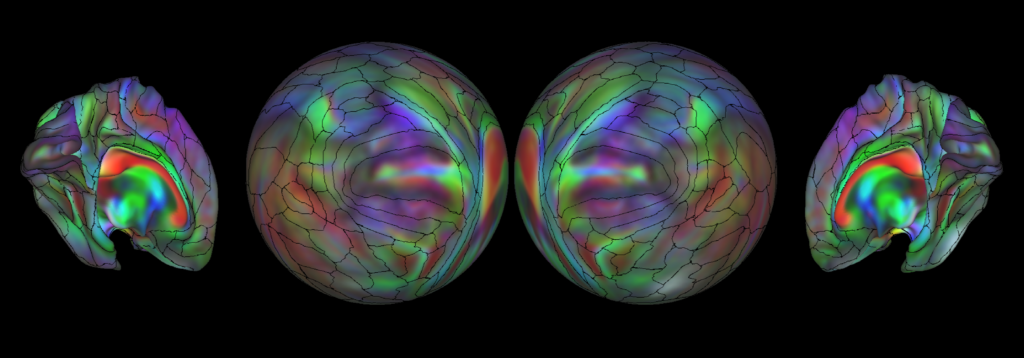 Retinotopy mapping that maps out four brain hemispheres.