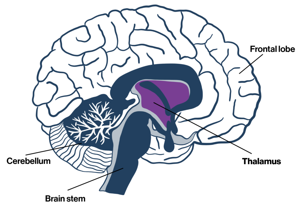 Diagram of brain.