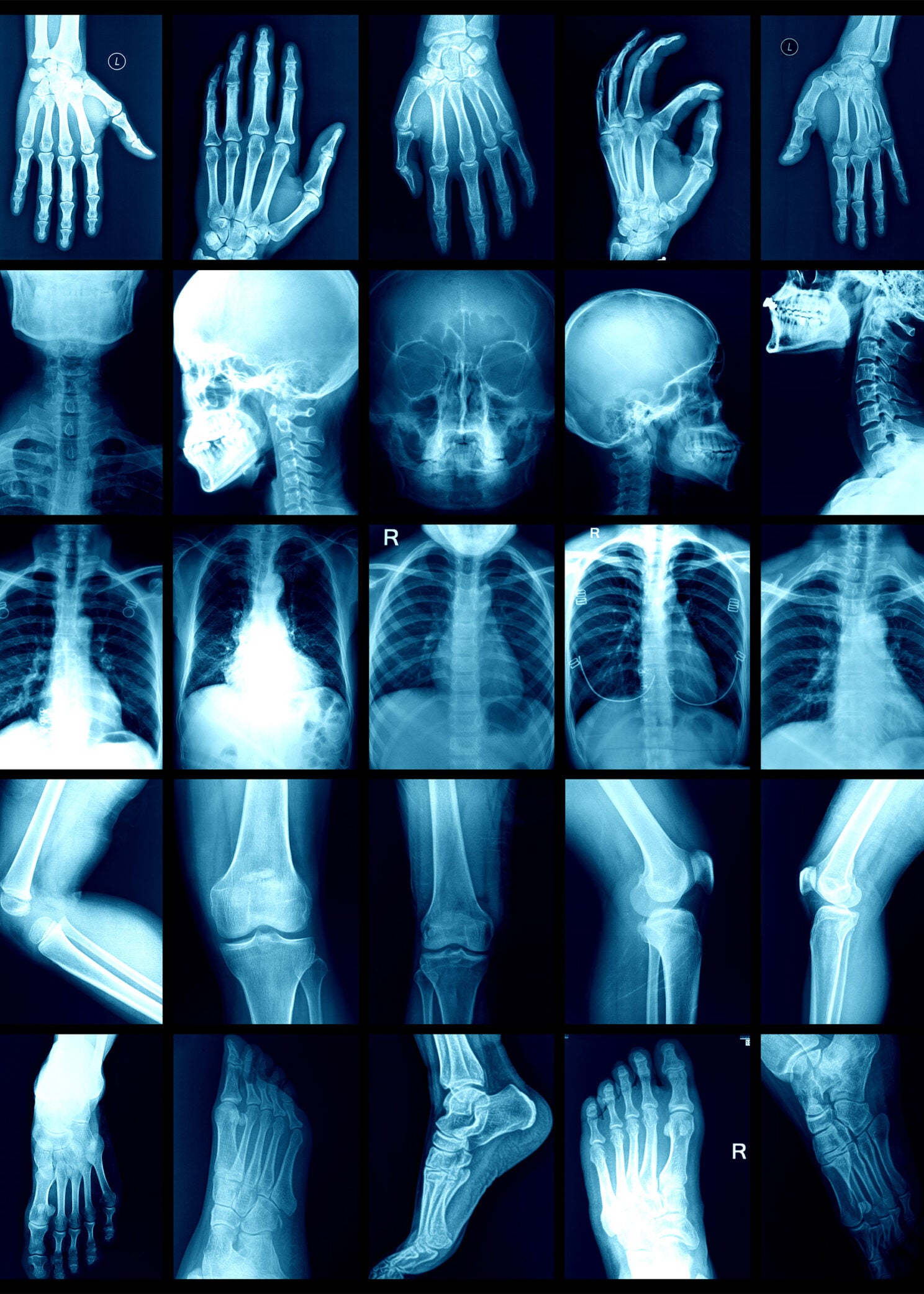 X-ray collage showing various joints, spine, and neck.