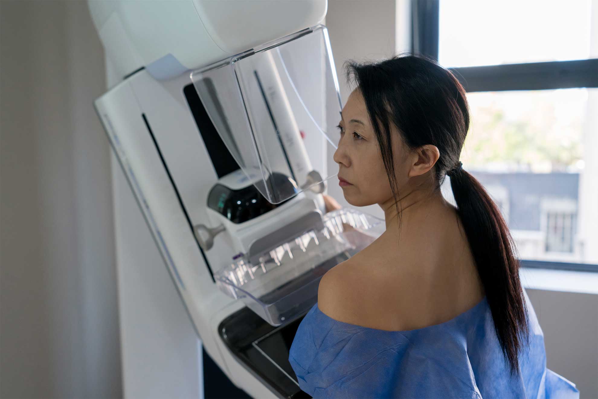 Rising Breast Cancer Rates in Young Women: Insights from American Cancer Society Report