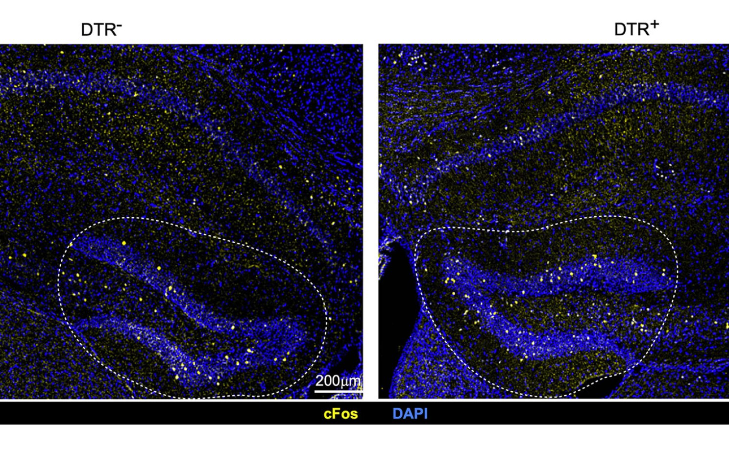 Differences in neuronal activation in mice with intact Tregs (left) and depleted Tregs (right).