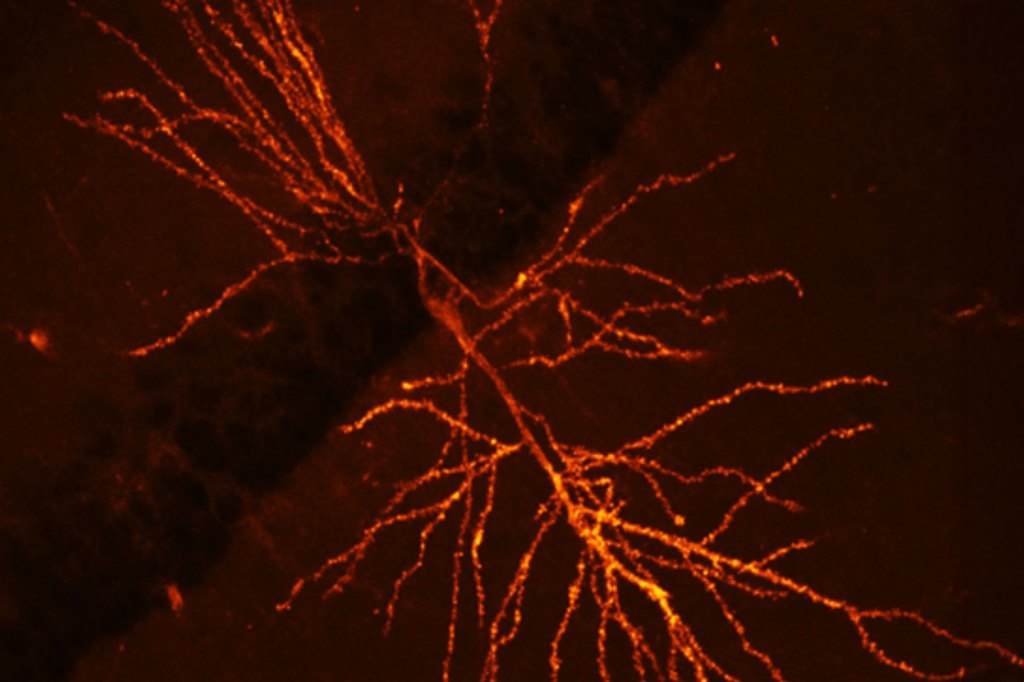 A combination of fluorescent labeling and cutting-edge microscopy allowed the researchers to illuminate synaptic behavior at unprecedented resolution.