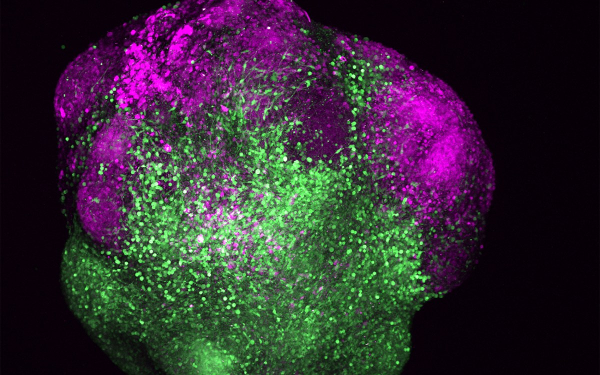 Human brain organoid