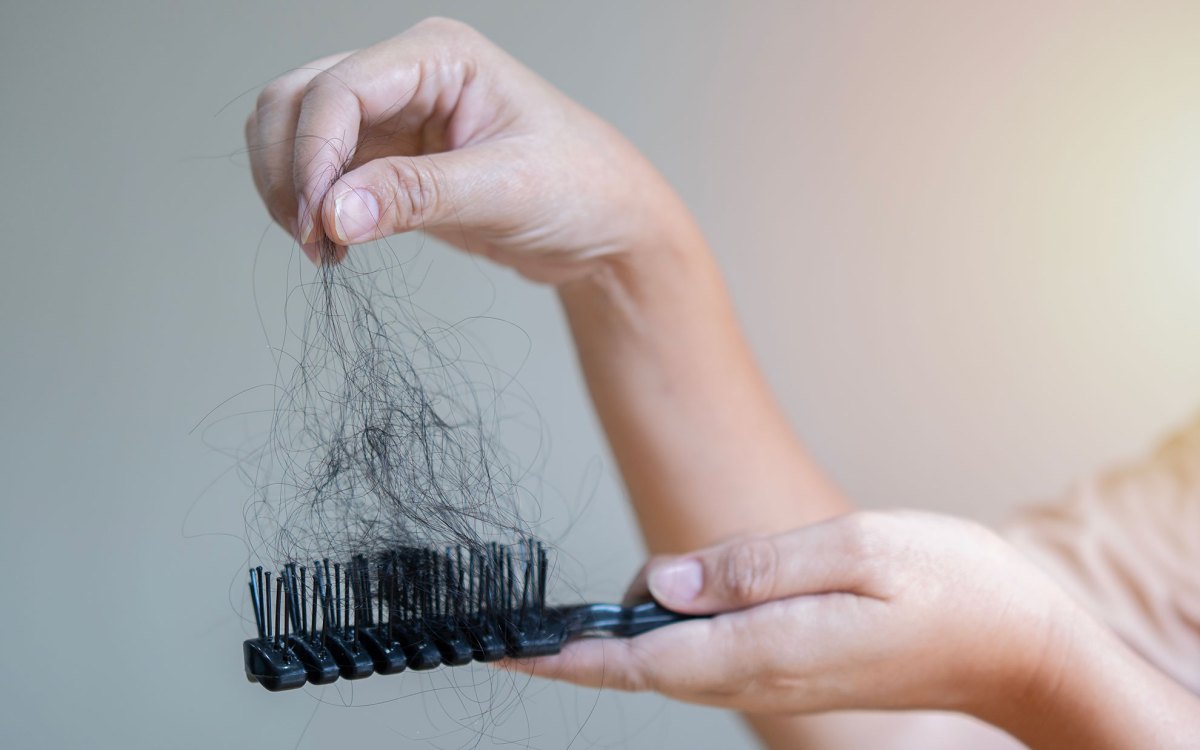 Hair loss problem concept.