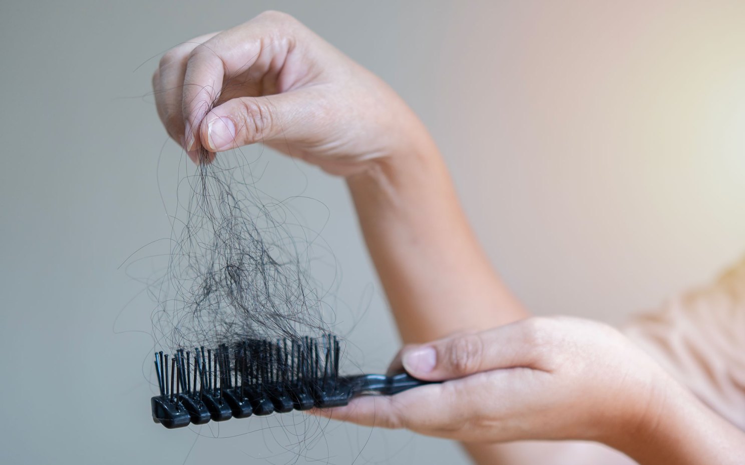 Hair loss problem concept.