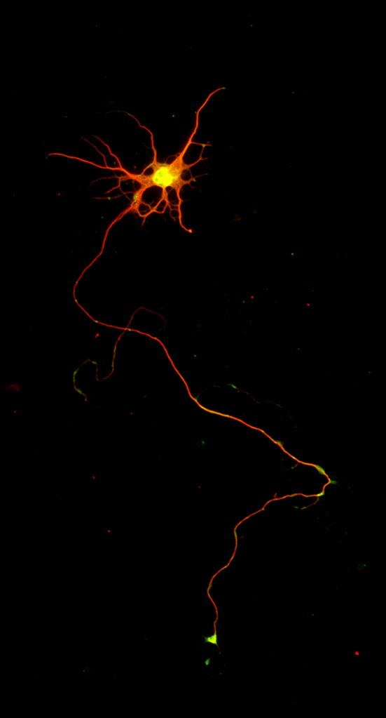 lab grown neuron