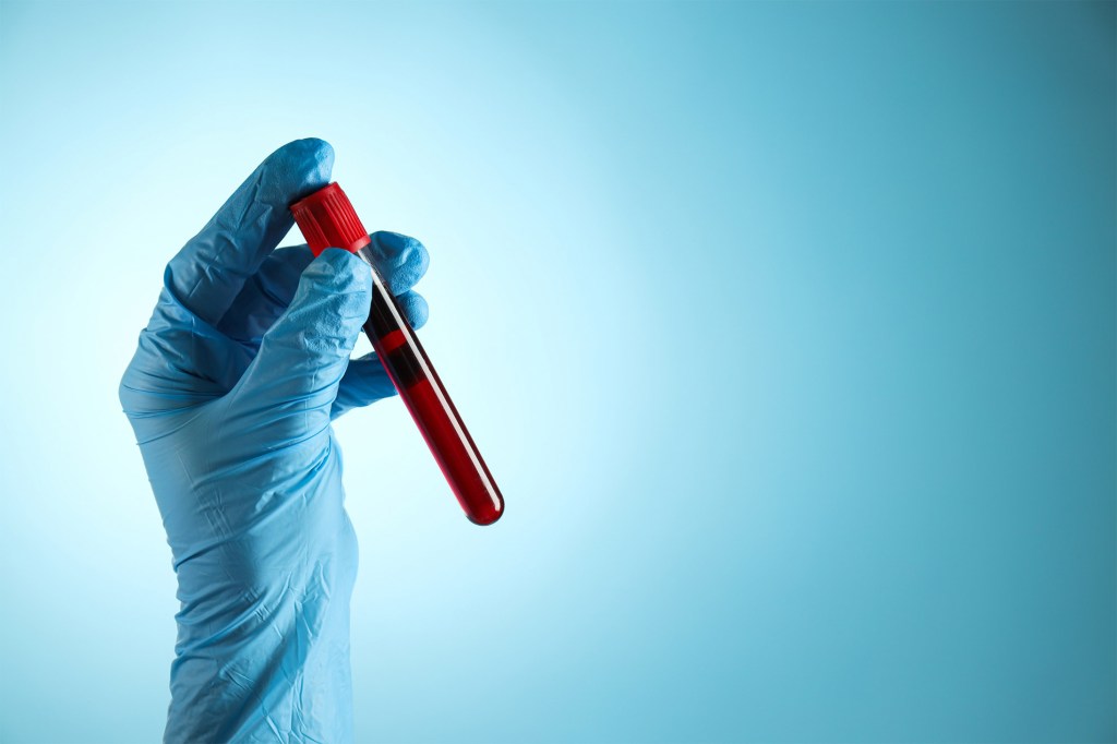 Blood in test tube.