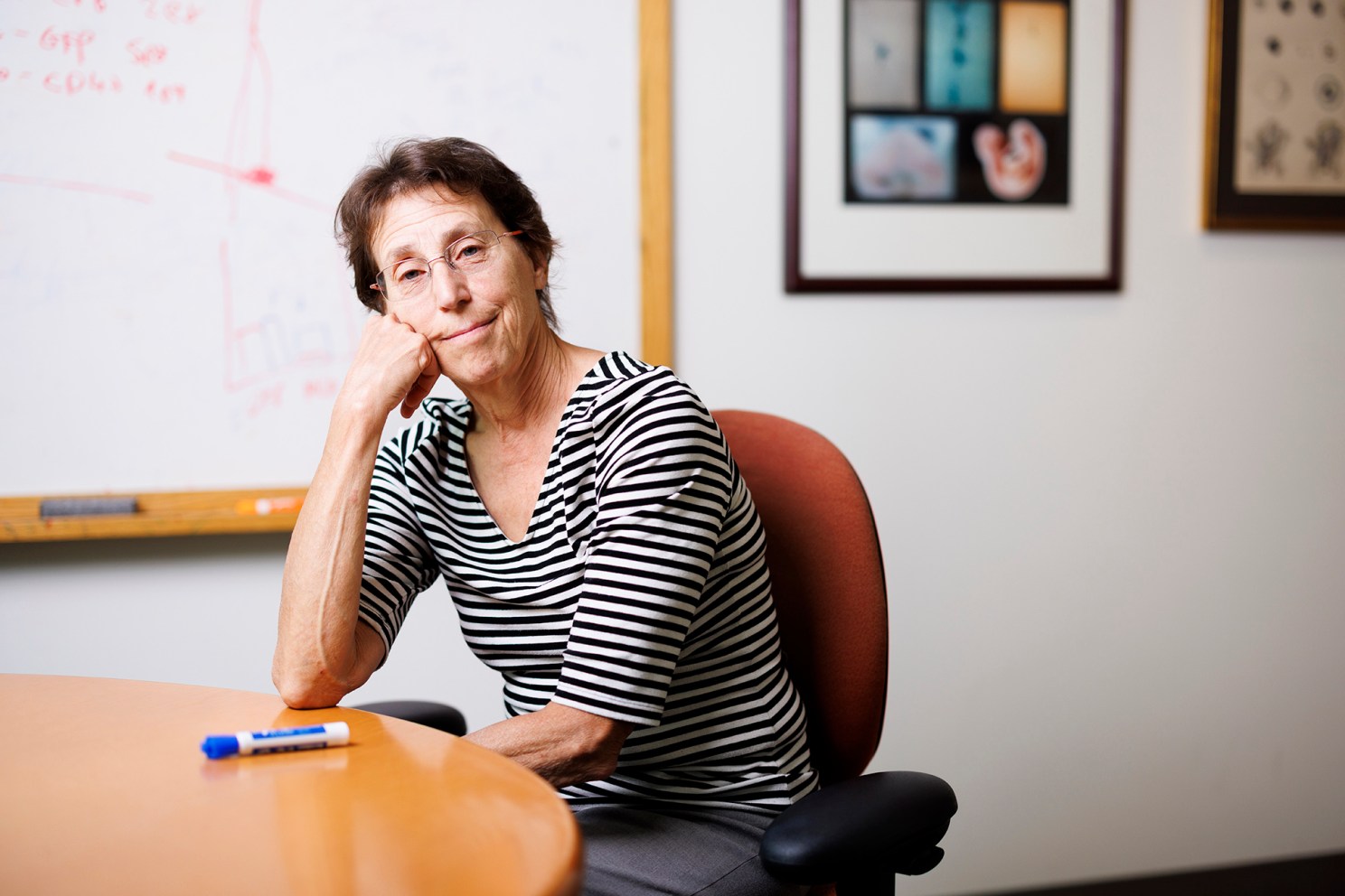 Connie Cepko.