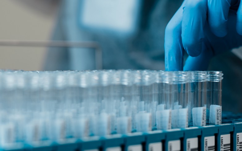 Lab technician pulls test tubes of specimens.