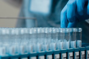 Lab technician pulls test tubes of specimens.